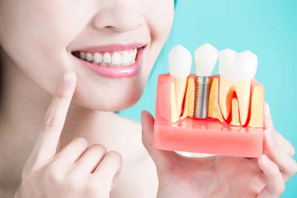 a dental patient holding up a model of a placed dental implant