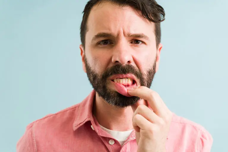 How Gum Disease Spreads (and How to Protect Yourself)