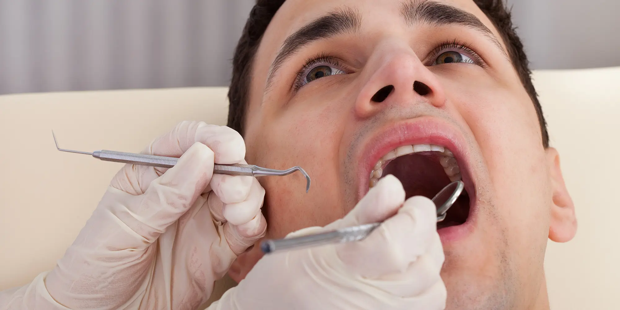 How Can I Get Rid of Black Gums?