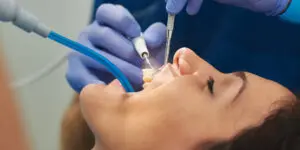 What’s the Difference Between Periodontal Maintenance and a Regular Cleaning?