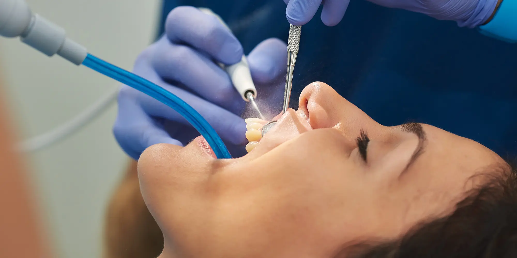 What’s the Difference Between Periodontal Maintenance and a Regular Cleaning?