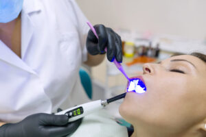 Advantages of Laser Dentistry