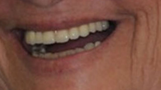 Smile Gallery Fort Lauderdale, FL