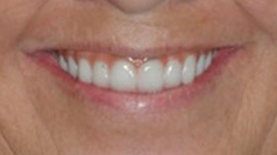 Smile Gallery Fort Lauderdale, FL