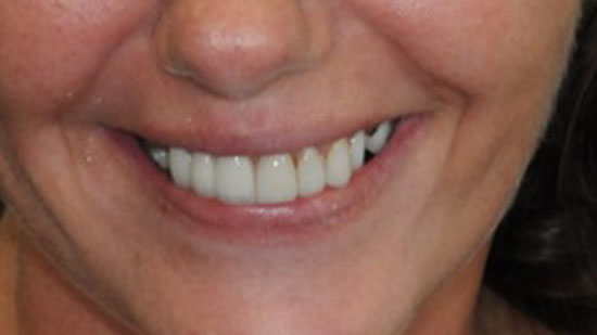 Smile Gallery Fort Lauderdale, FL