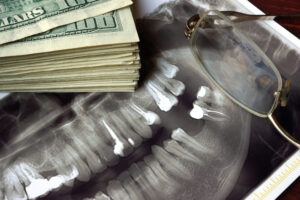 Dental Implants: Pain and Cost