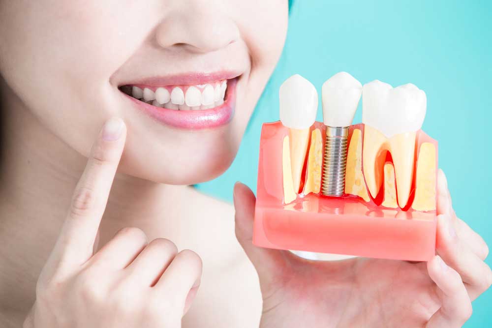 a dental patient holding up a model of a placed dental implant