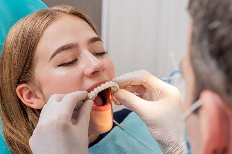 a dental professional showing full mouth dental implant restorations.