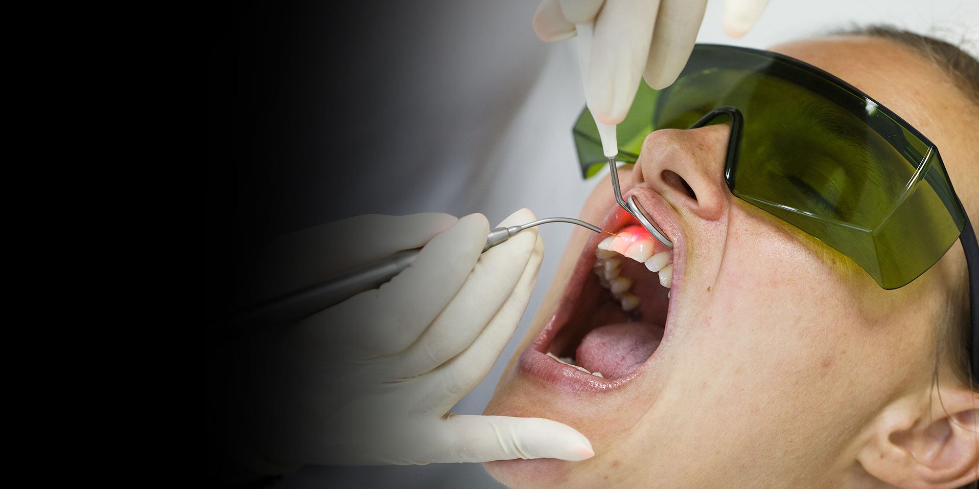 laser gum disease patient being treated