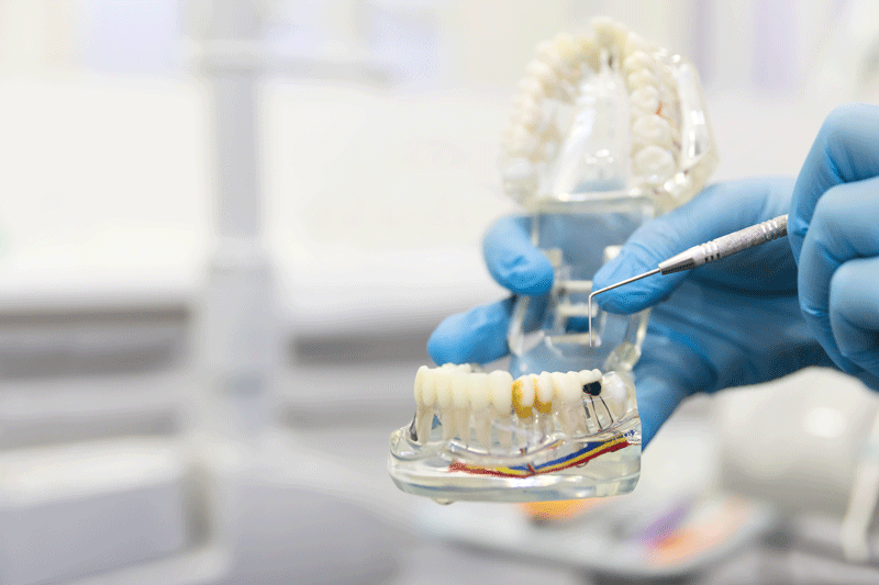 Dentist showing a model of a lower jaw with implants in it with a blurred background.