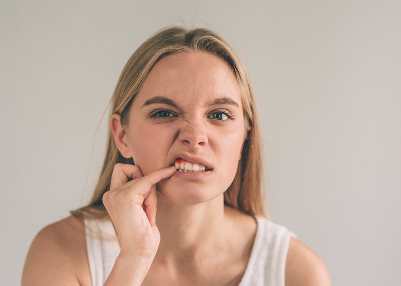 A woman looking at the camera and showing her bleeding gums from gum disease.