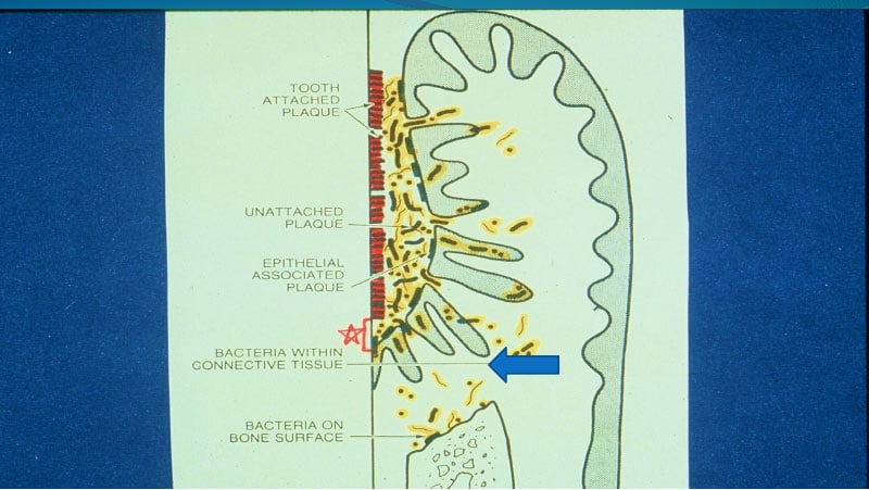 slide6