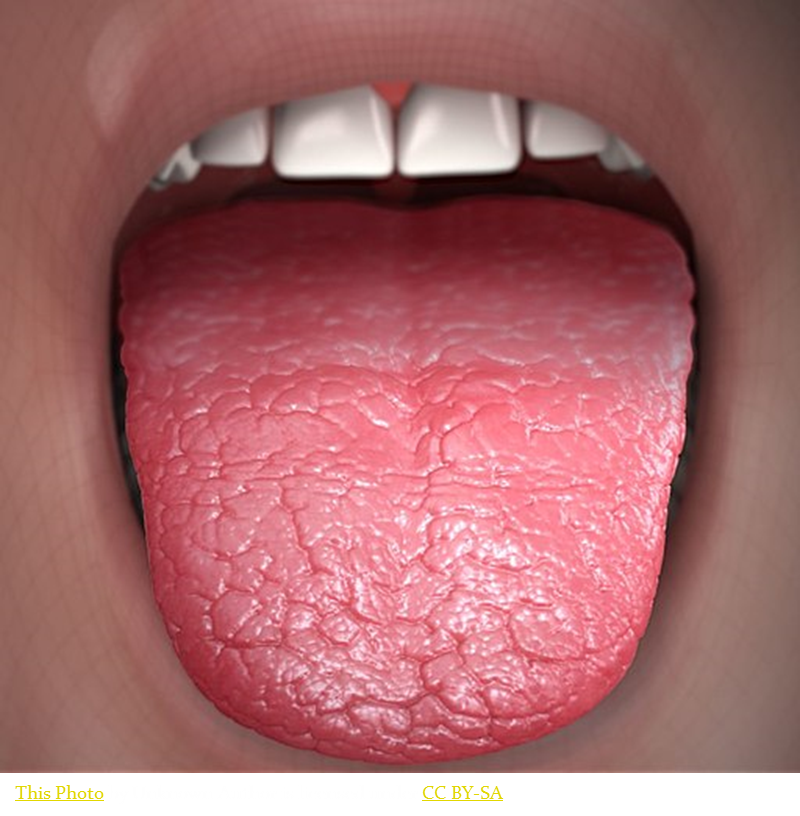 Rendering of an extremely dry mouth