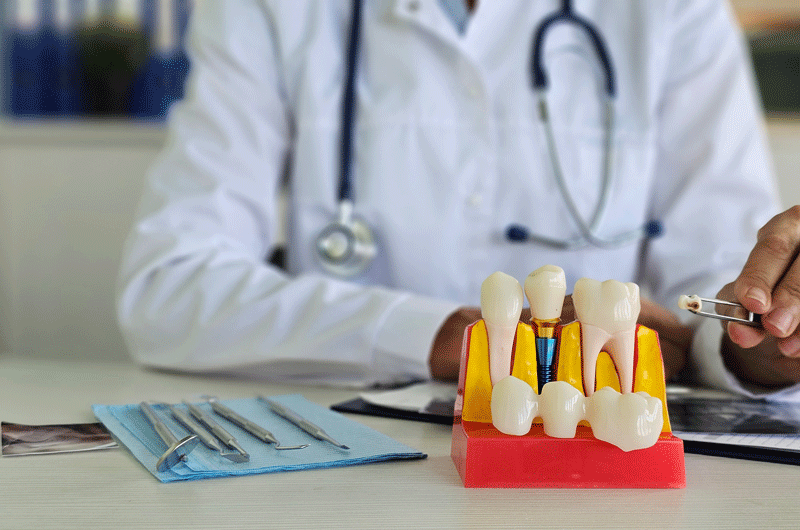 Discover how dental implant procedures can provide a permanent solution for missing teeth. Learn about the process and benefits at our practice.