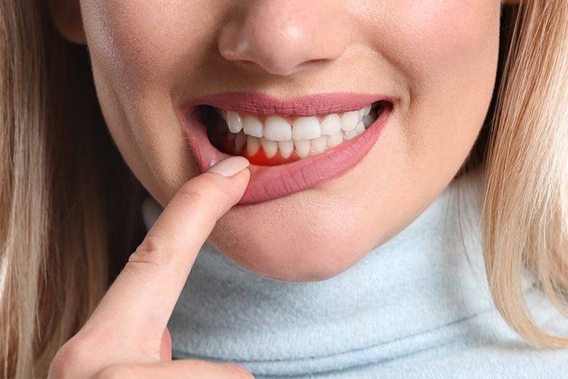 Can Gum Disease Be Reversed? What You Need to Know