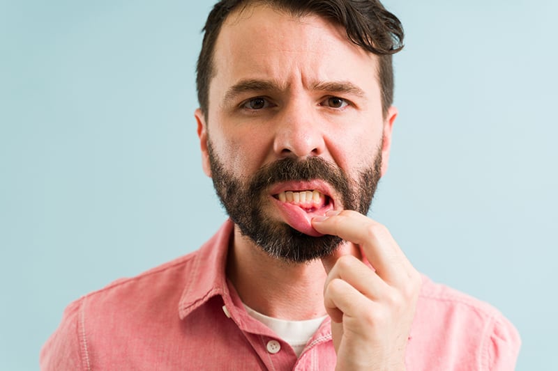 How Gum Disease Spreads (and How to Protect Yourself)