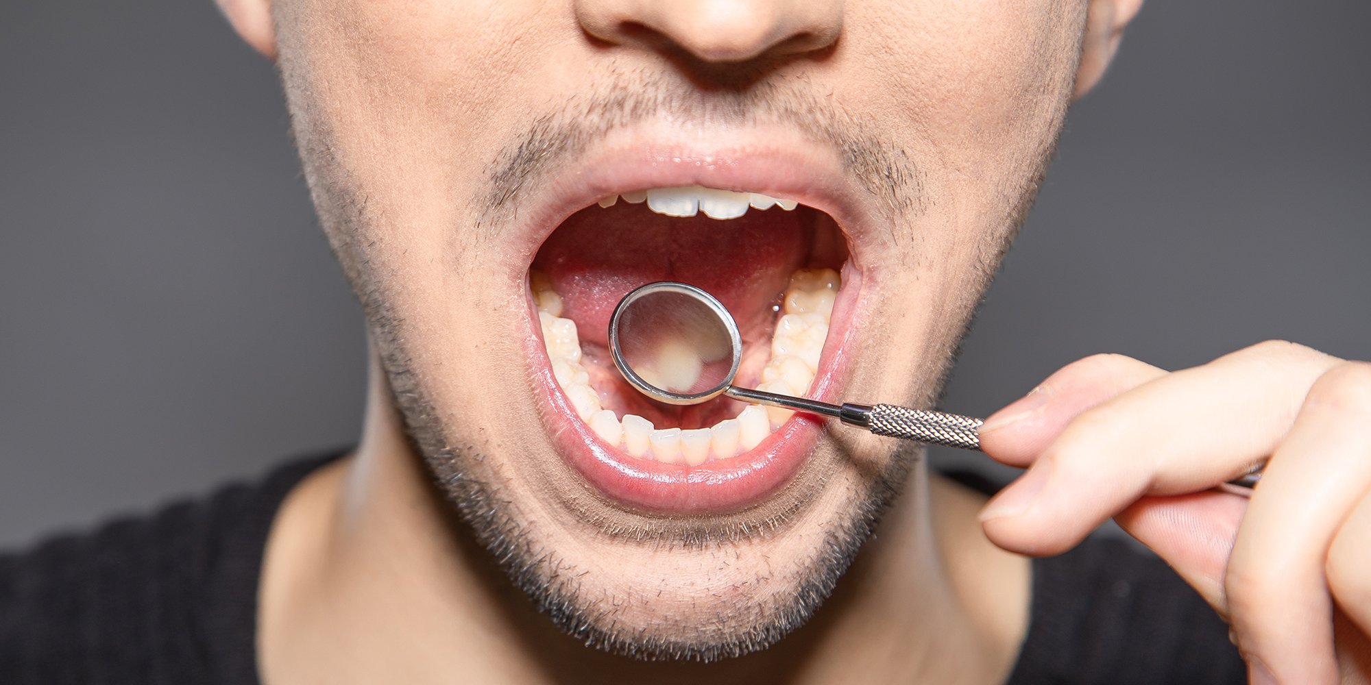 Can Dry Mouth Cause Periodontal Disease?
