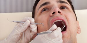 How Can I Get Rid of Black Gums?