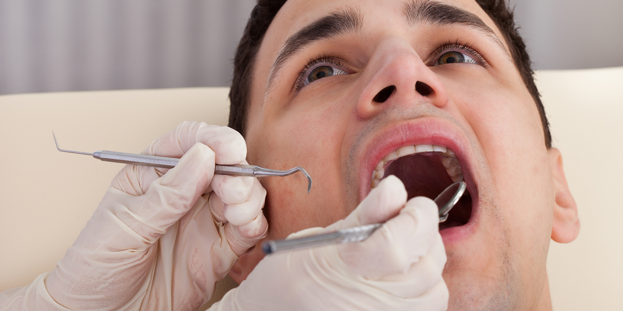 How Can I Get Rid of Black Gums?