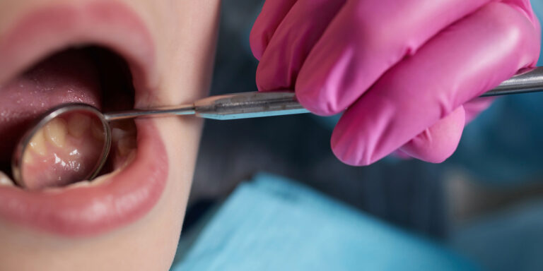 LANAP in Fort Lauderdale: Everything You Need to Know