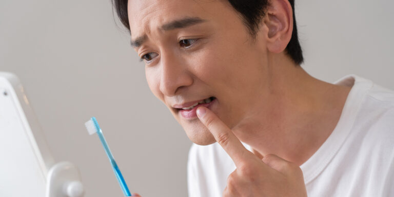 7 Everyday Habits That Cause Gum Recession