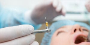 How Long Does a Dental Implant Procedure Take?